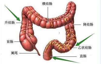 又一明星父親直腸癌晚期胃腸鏡篩查要趁早否則有錢也莫法