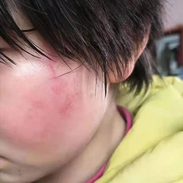 孩子在校摔伤,家长和老师在班级群互撕,大爆粗口,谁更有问题?