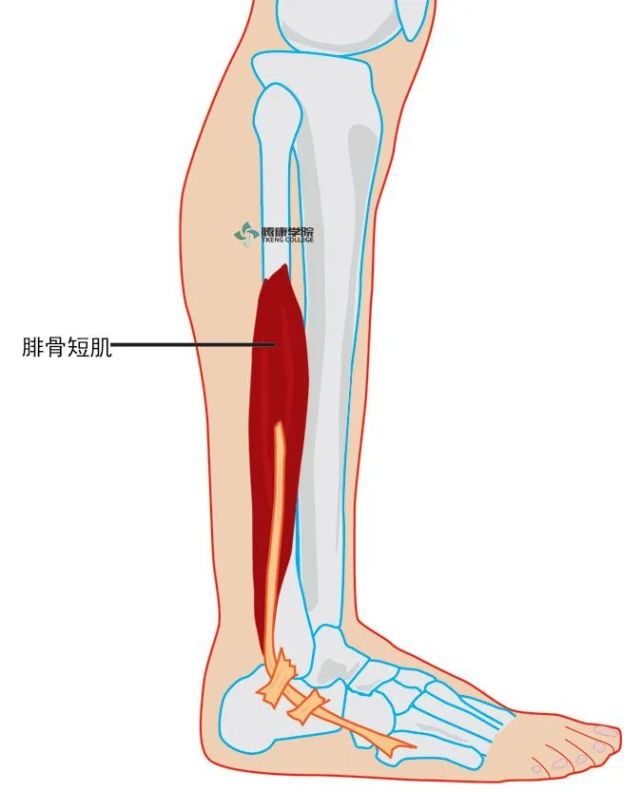 足外翻受限关键肌腓骨肌