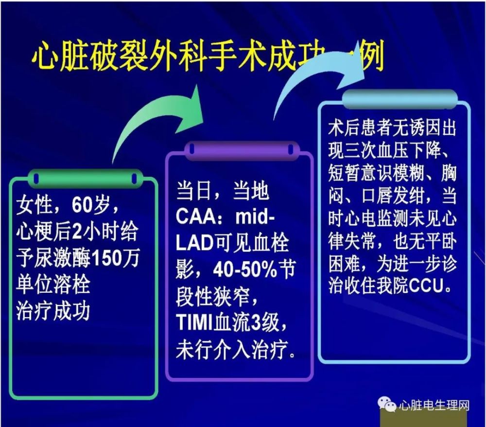 pci时代ami救治进展与挑战