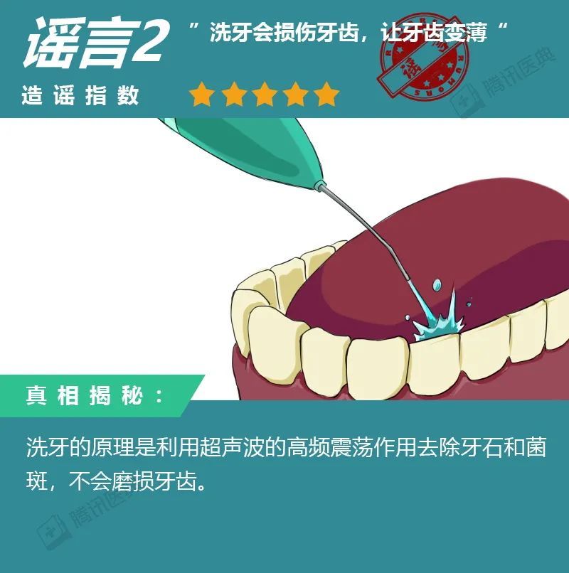 牙周袋冲洗步骤图片