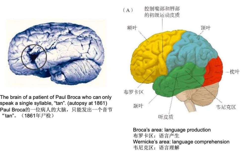 布罗卡氏区图片