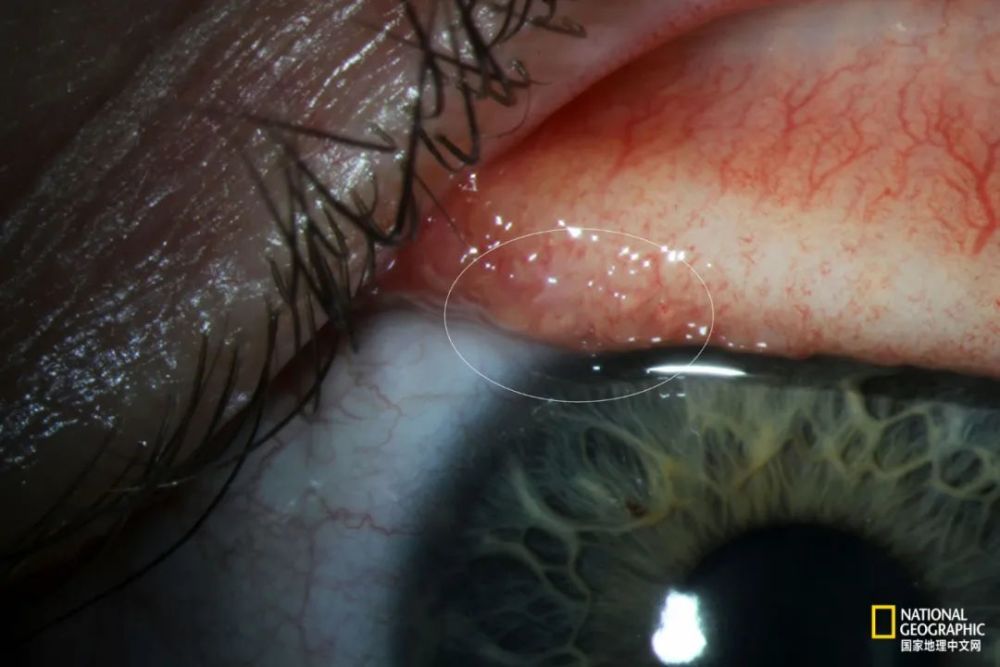 为啥要保护这么恶心的东西