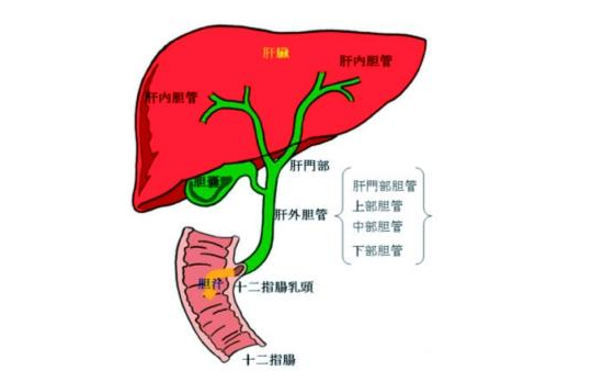 胆结石过大,医生都会建议切除胆囊,防止各种并发症.