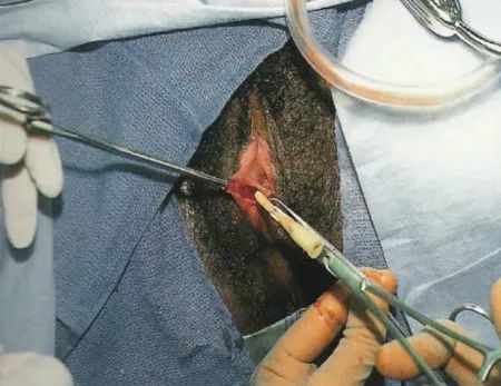 2008;28(2):161-165怎么区分前庭大腺脓肿和前庭大腺囊肿前庭大腺