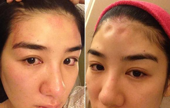 黄奕一边回应出轨绯闻,一边晒出自己被家暴的照片.