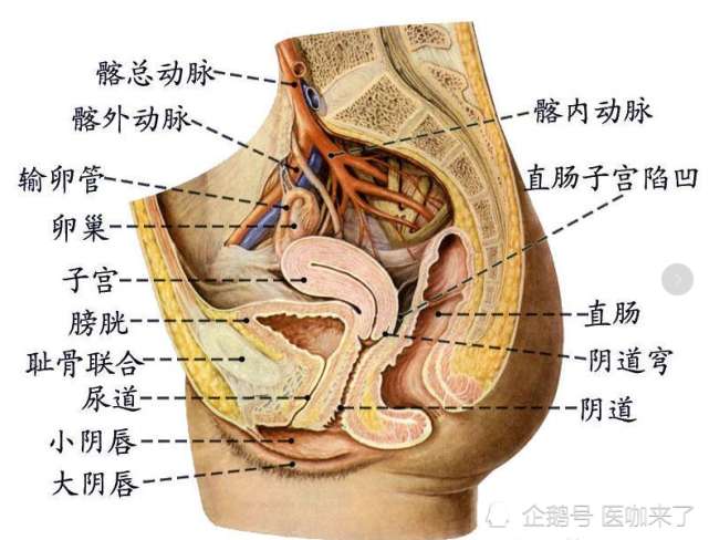 盆腔积液是人体一些腹腔漏出的液体积聚在子宫直肠陷凹(道格拉斯窝)