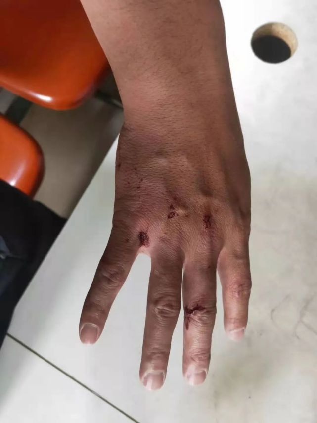 【月度"平安之星"】张亮亮:他是"拳头"警察,为救人两度赤手空拳砸车窗