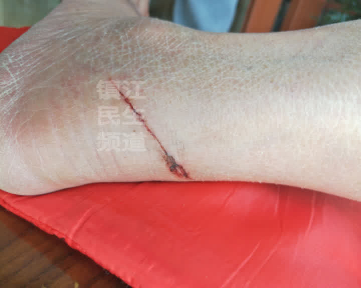 被撞电动车主 :当时吓得我心脏直跳,魂都吓没了,还好没有骨折,万幸
