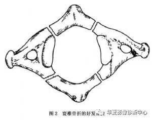 如雙側側方移位總和超過7mm者,則表示寰椎橫韌帶斷裂.