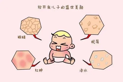 宝宝疹子母乳饮食禁忌(宝宝起疹子 母乳喂养需要注意什么)-第2张图片-鲸幼网