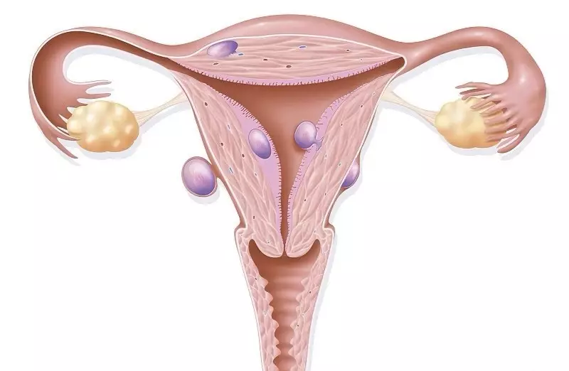 50 以上的女性都有子宫肌瘤 腾讯新闻