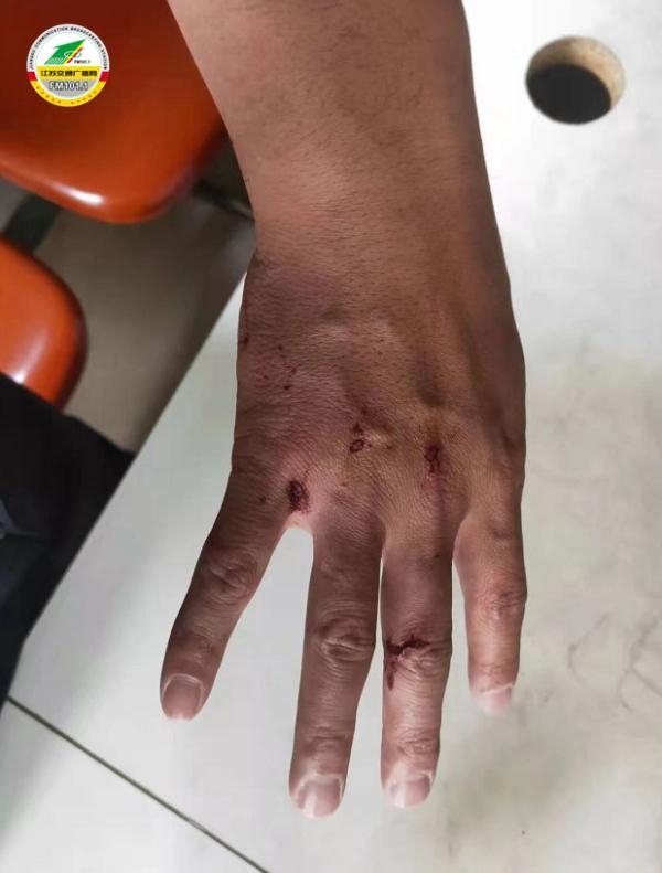 危急关头,他用拳头砸开车窗!这不是第一次