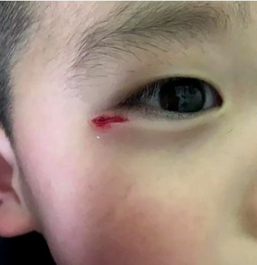 三岁男童玩具店摔伤缝8针监控记录全过程