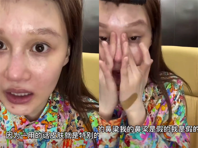 赵本山女儿球球素颜直播,卸妆后黑眼圈明显,透露自己有整容!