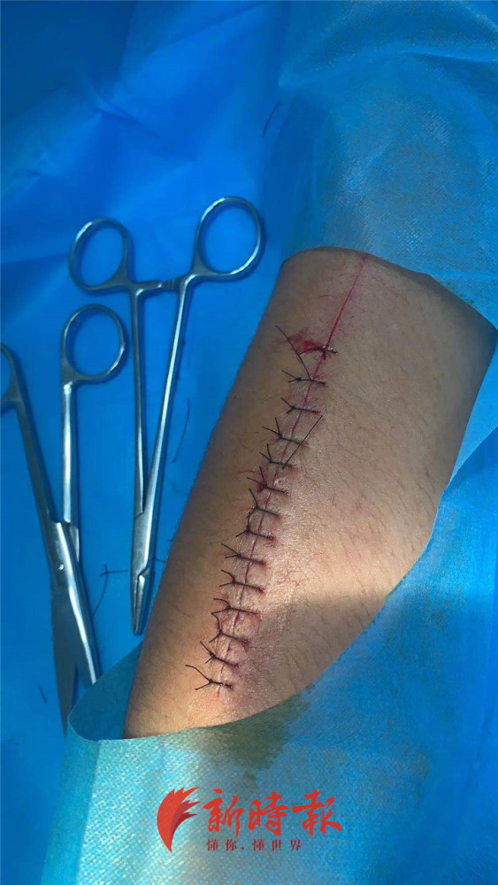 山东自残求复磅司机发声我跟自杀的金德强一样感到委屈和无助