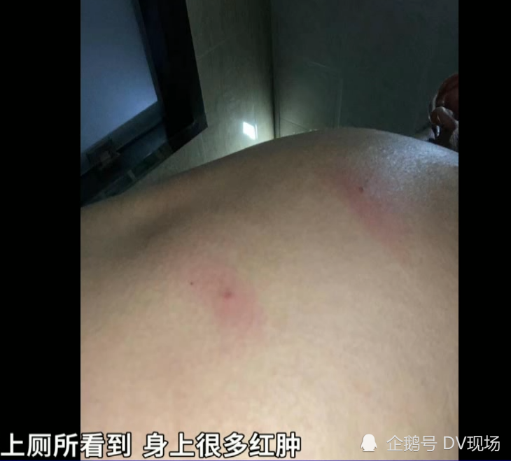 黄先生手上摸到的居然是个小虫子,而被子上还有虫子在爬,大只的有筷子