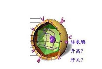 肝病早知道谷丙轉氨酶偏高肝病是這樣嗎