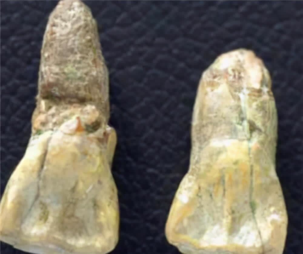 在1959年,北京周口店遗址出土了著名的北京猿人,铲形门齿成为了我们和