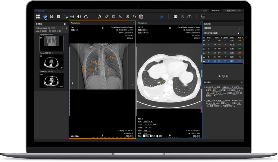 柏视医疗|人工智能赋能医学影像,为影像科添翼,做影像科医师的好帮手