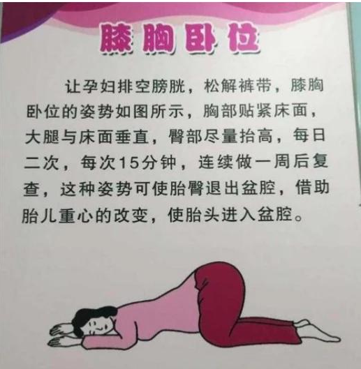 胎位不正不能顺产答案不一定纠正胎位黄金时期孕妈要记住