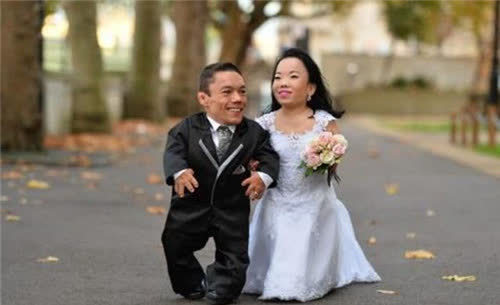 他前半生是1米22的侏儒,后半生是2米16的巨人,百年来仅此一人|侏儒症