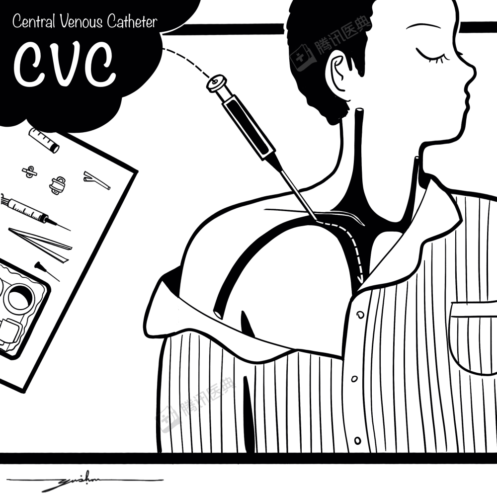 此前化疗置入的picc管(经外周置入的中心静脉导管)被拔出,后来几次