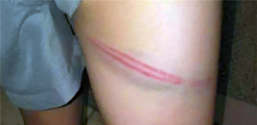 新加坡的鞭刑真那么恐怖为何很多人宁愿坐牢也不想挨一鞭子