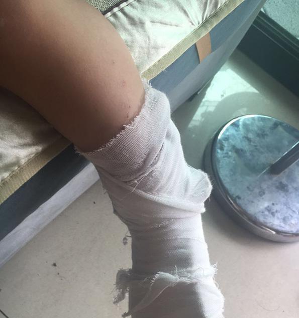 男童遭商场电梯夹断脚趾,家属以标识不醒目状告商场,网友怒了!