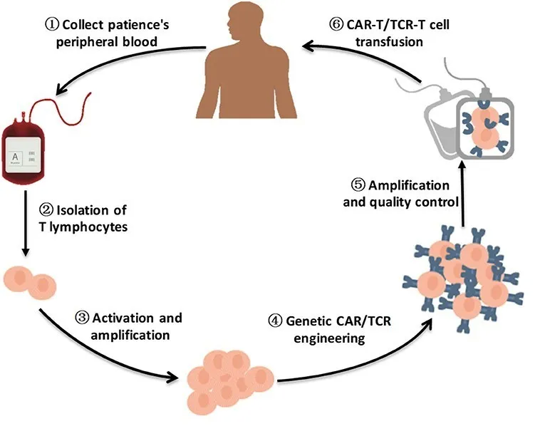 细胞免疫疗法(chimeric antigen receptor t-cell immunotherapy,car