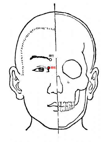 睛明穴头痛眩晕