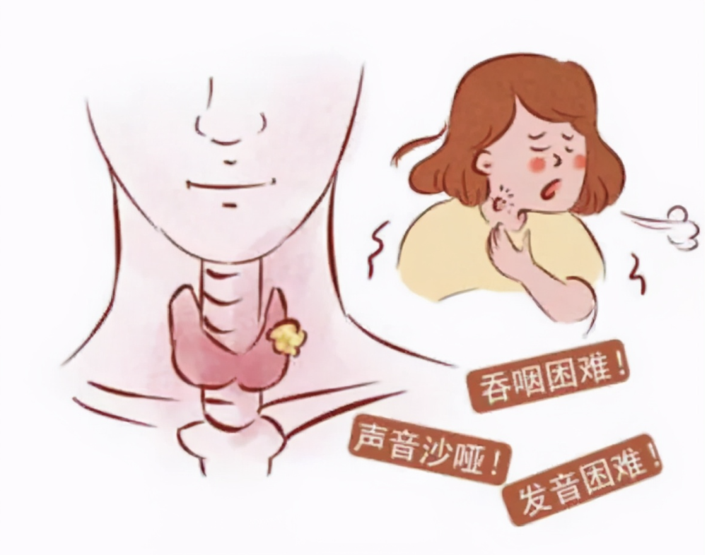 查出甲状腺结节距离癌症有多远