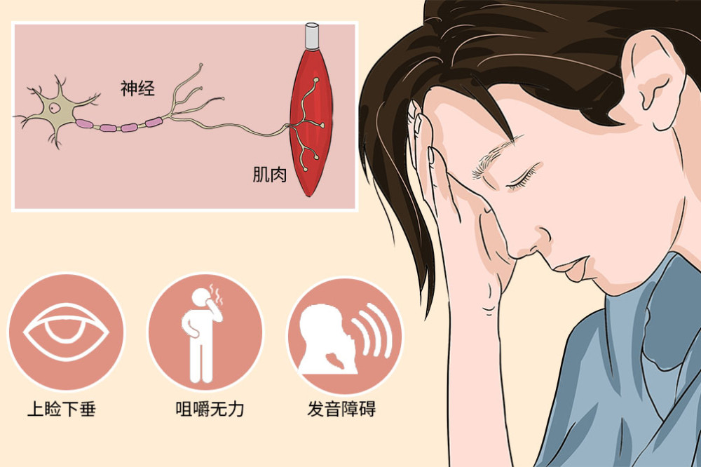 全身型重症肌無力患者經休息和膽鹼酯酶抑制劑治療後症狀減輕