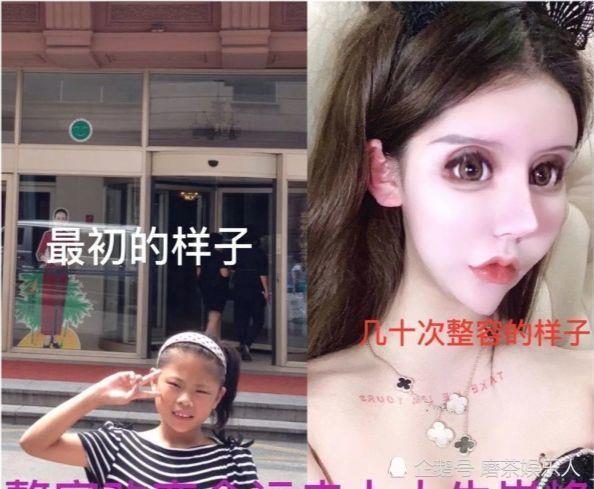 通过周楚娜分享的整容前后对比来看,她所谓的"整容改变命运",实在难