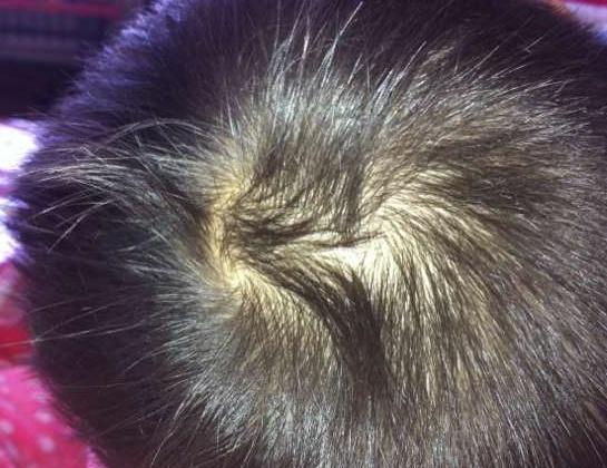孩子头上"旋"的个数会有何影响?可能很多人还不清楚,不妨了解