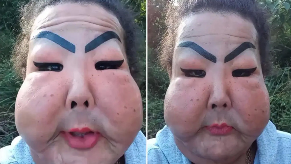巴西女子贪小便宜导致整容失败,如今脸像带上鬼面具_腾讯新闻