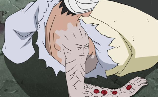 火影忍者:在移植了柱间细胞的忍者中,为什么柱间脸谱会有选择性_腾讯