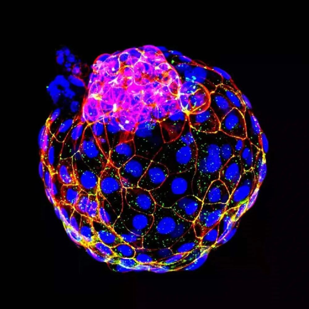 专访季维智院士:全球首个人猴嵌合体诞生!