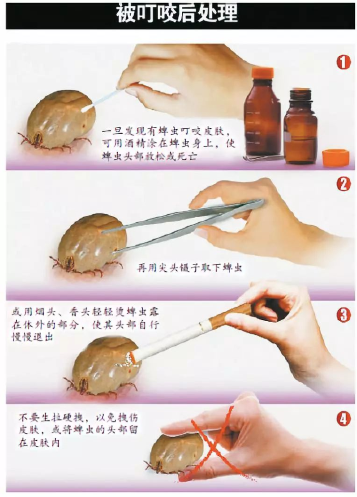 银狐被33只蜱虫群殴自行求助警察网友大喊太聪明了