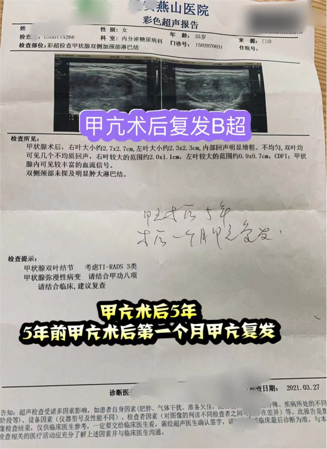 患者甲亢术后才一个月又复发 是什么原因导致的 甲亢 甲状旁腺功能亢进