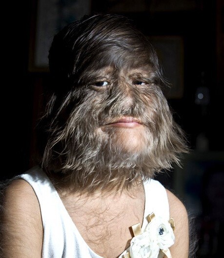 身高不足1米4的"多毛女":20多位商人向她求婚,只为利用她赚钱