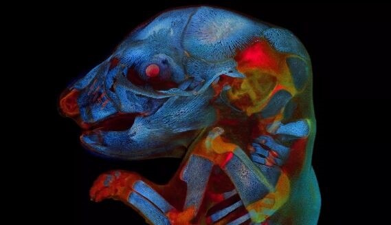 21天大鼠胚胎照获科学摄影奖:眼冒红光,身体散发蓝色幽光
