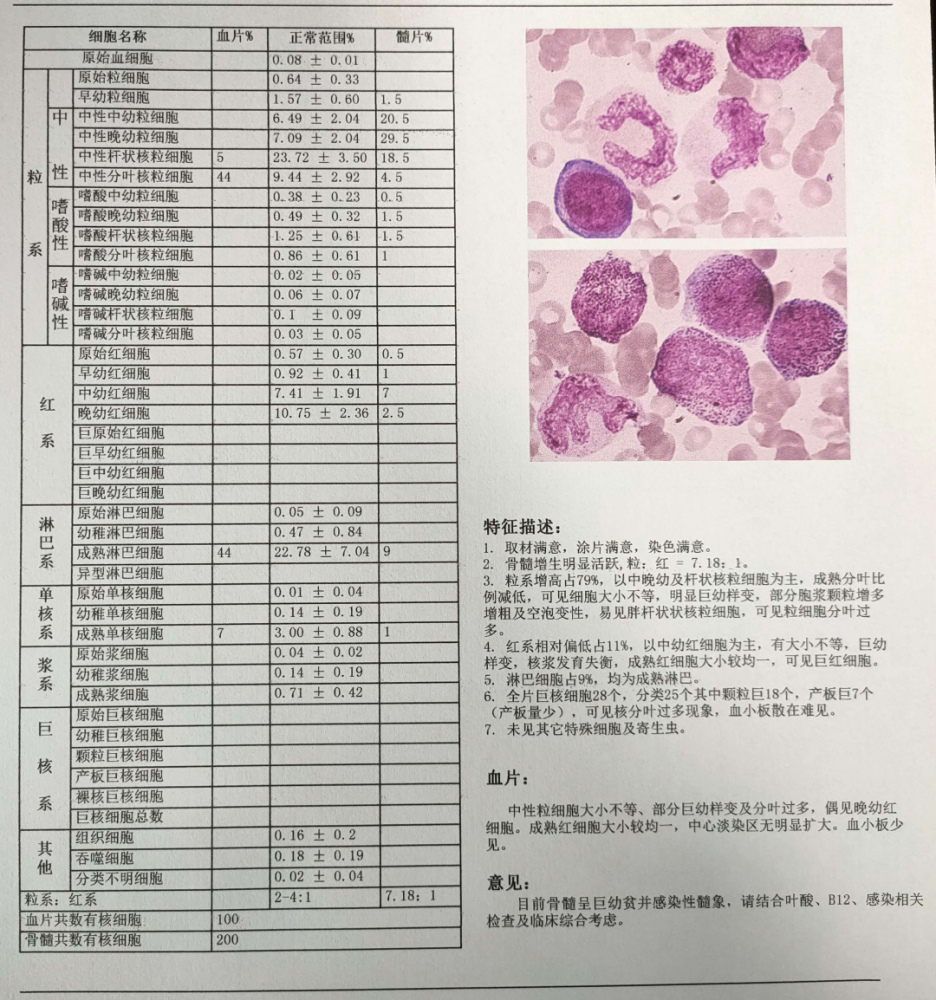 骨髓细胞学报告单治疗期间患者间断抽搐,考虑缺血缺氧性脑病,病程中