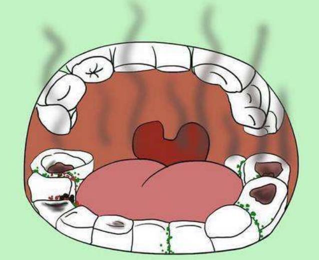 早上起床后不刷牙就喝水的人最后得到了什么看完文章就懂了