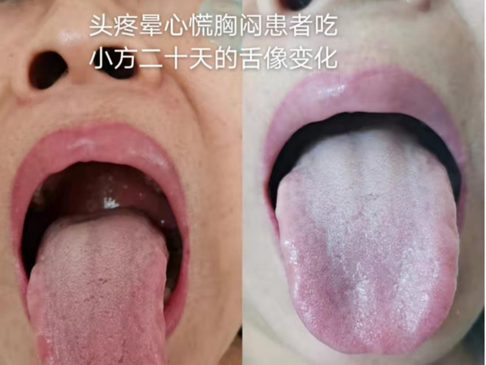 4月北京吴仕金空间医学舌诊小方让中医小白快速变成空间医学开方高手