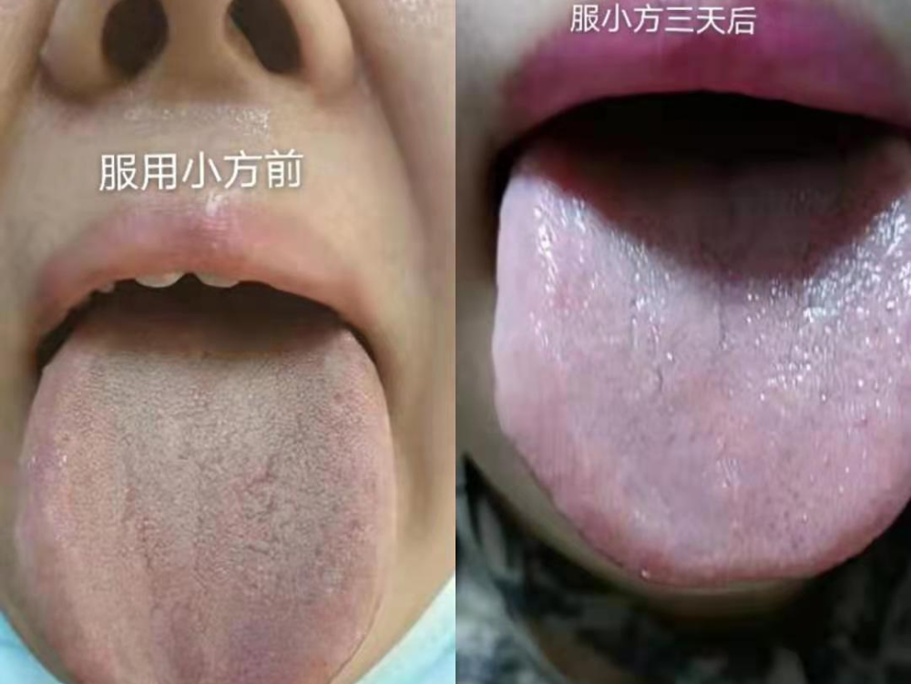 4月北京吴仕金空间医学舌诊小方让中医小白快速变成空间医学开方高手