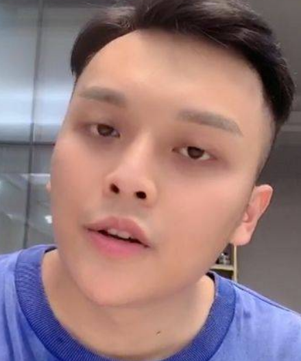 小猪先生整容前照片曝光,脸宽肥胖不像同一个人,变化太大了