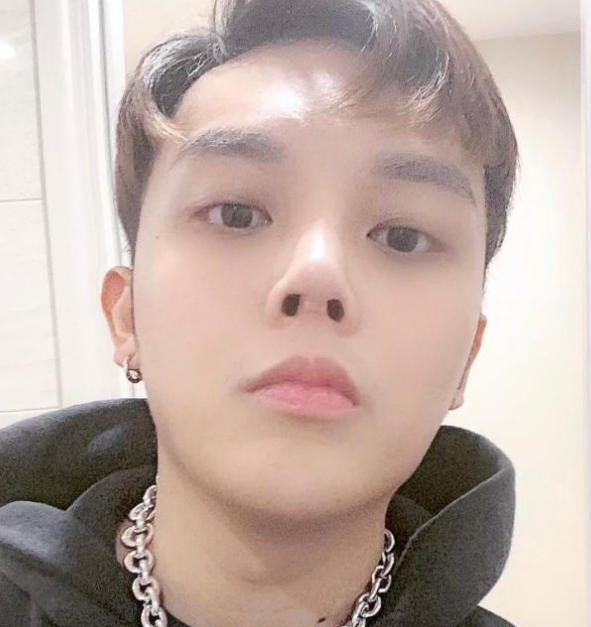 小猪先生整容前照片曝光脸宽肥胖不像同一个人变化太大了