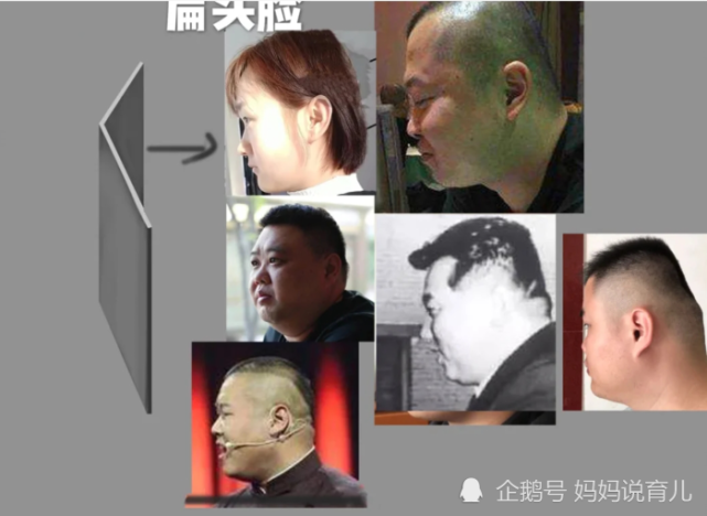 宝宝头型不好看怎么办两个步骤解决问题亲测有效