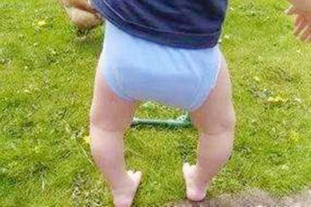 孩子有o型腿,源于父母这4点对孩子的忽视,尤其是第2点,少做少好